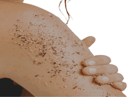 THREE STEP ANTI-ACNE BODY SYSTEM - FOR WOMEN